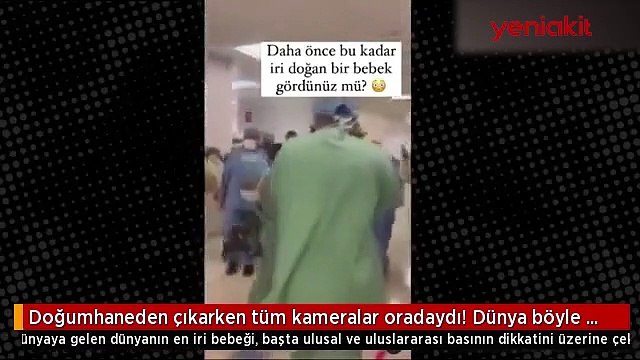 Dünya böyle bir bebek görmedi! Dev bebek görenleri şaşırtıyor