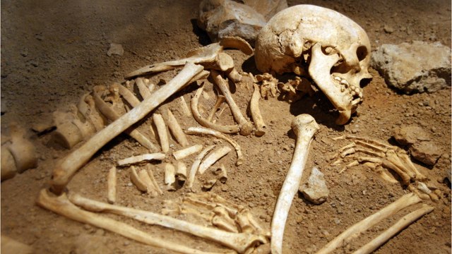 man's skeleton reveals he had replaced his amputated hand with a knife