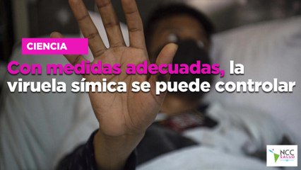 Con medidas adecuadas, la viruela símica se puede controlar