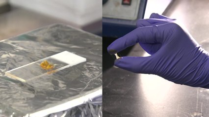 [뉴스라이더] 모발 접착제 개발...탈모 해결에 실마리? / YTN