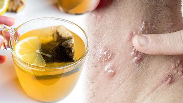 नींबू चाय पीने के होते है गंभीर नुकसान ,ये लोग भूलकर भी न करें सेवन । Boldsky *Health