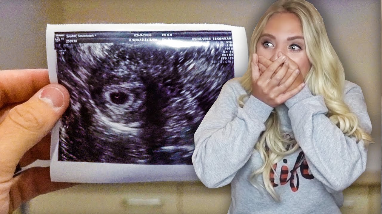 SEEING OUR BABY FOR THE FIRST TIME!!!