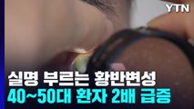 '실명 위험' 황반변성, 40∼50대 환자 4년 새 2배 급증 / YTN