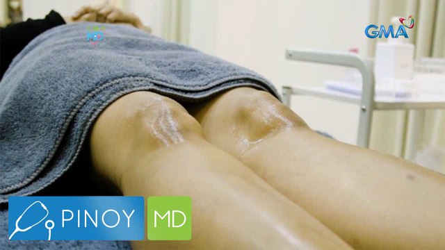 Chemical peel solution, epektibong pampaputi nga ba ng mga tuhod? | Pinoy MD