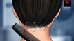 Removal big flakes dandruff scalp satisfying ASMR