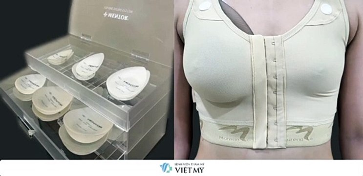 Mô phỏng 3D trước khi phẫu thuật thẩm mỹ tại bệnh viện thẩm mỹ Việt Mỹ