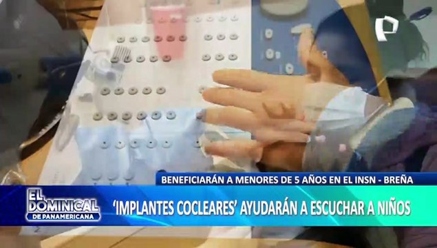 INSN -Breña: “Implantes Cocleares” ayudarán a escuchar a menores de 5 años