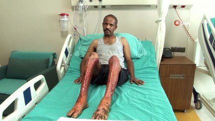 Türkiye’ye getirilen hastalar felaket anlarını anlattı! “Gözümün önünde yandılar”