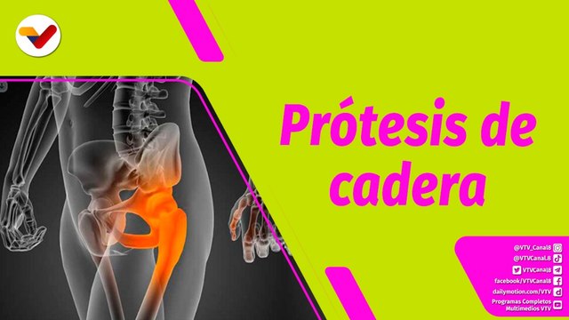 Buena Vibra | Conoce cuándo es necesario colocar una prótesis de cadera
