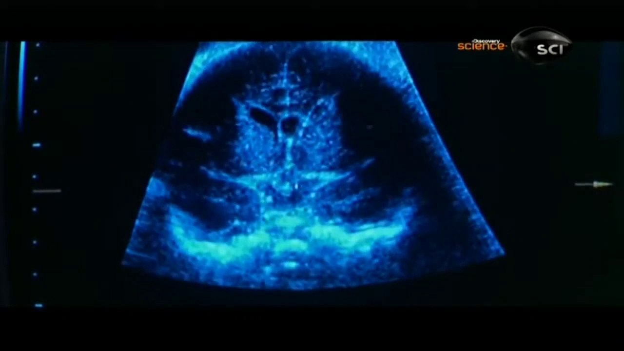 Documentário - O Homem do Futuro - HD