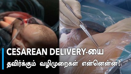 Childbirth | Normal Delivery ஏன் குறைந்து விட்டது தெரியுமா?
