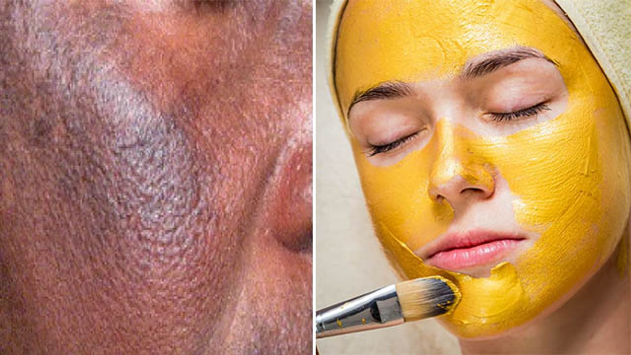 चेहरे पर रोज बेसन लगाने से क्या होता है ?Chehre Par Roj Besan Lagane Se