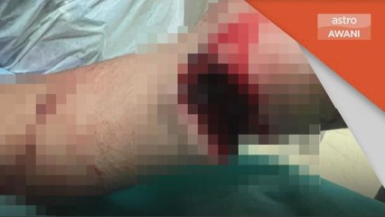 Jenayah | Pegawai dan anggota polis cedera dilibas parang