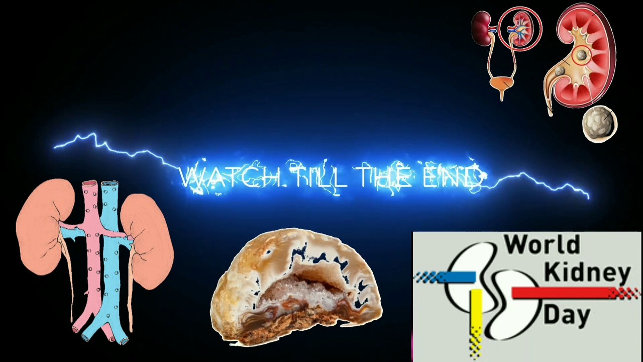 Pain in the lower back is due to stones/There is a problem of kidney stones #English #urdu #pashto #QFRTech