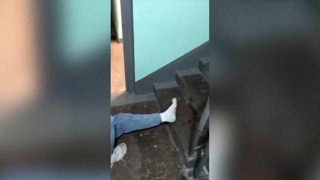 Askere gitmemek için bacağını böyle kırdı