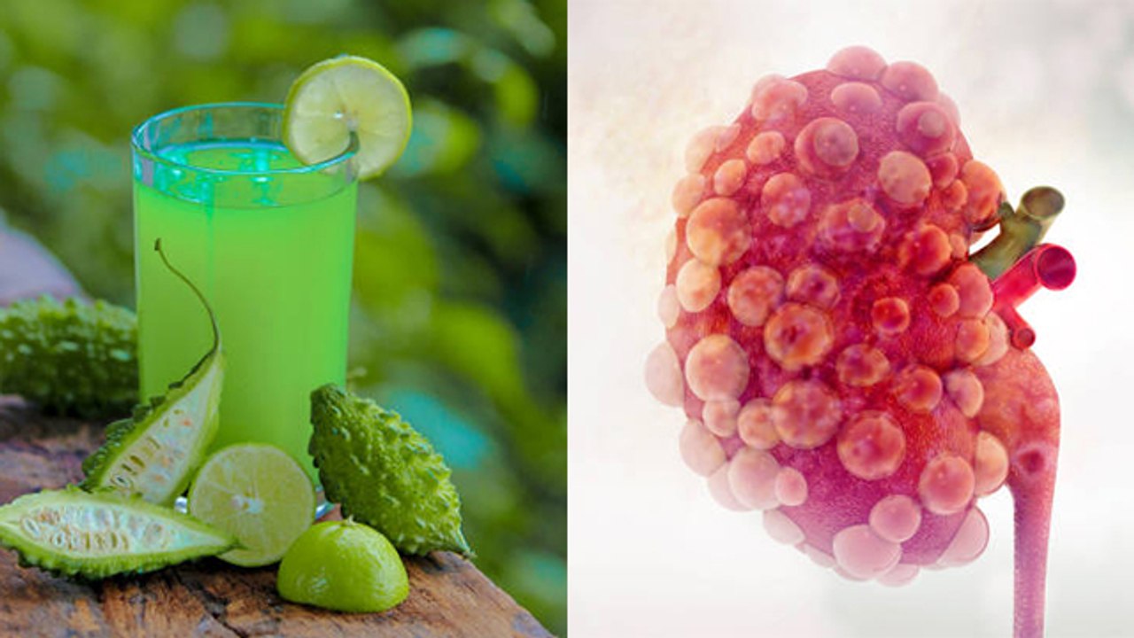 यूरिक एसिड की समस्या कम करेगा करेला | करेले से कम होगी यूरिक एसिड की समस्या | Boldsky *Health