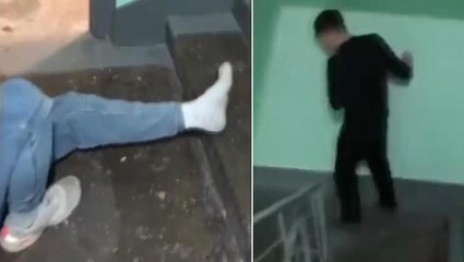 Rusya'da seferberlik kaosu büyüyor! Askere gitmek istemeyen genç, arkadaşına ayağını kırdırdı
