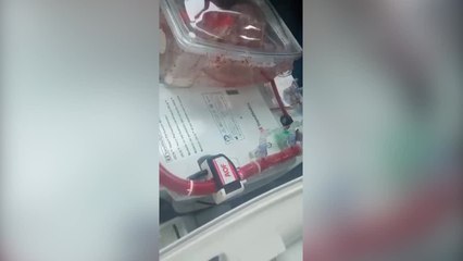 Oltre una persona su tre muore per malattie del cuore