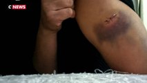Seine-Saint-Denis : Une mère et sa fille agressées au couteau