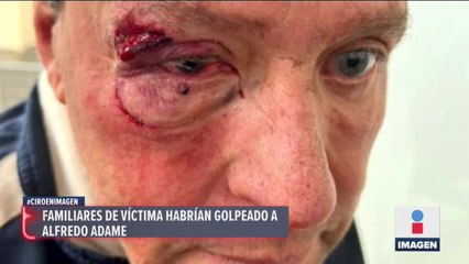 Dan golpiza a Alfredo Adame cerca de su casa en Tlalpan