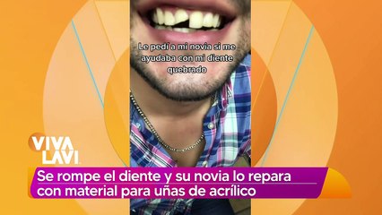 Se rompe el diente y novia lo repara con acrilico para uñas