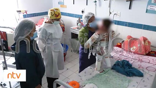La niña quemada en Tiquipaya ya recibió injertos de piel