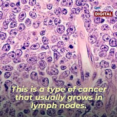 Siblings shave hair for sister with cancer | Make Your Day