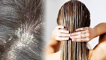 बालों में शहद लगाने से क्या होता है । बालों में शहद लगाने के नुकसान । Boldsky *Health