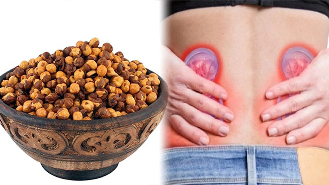 Stone में चना खाना चाहिए या नहीं ? | Pathri me Chana khana chahiye ? | Boldsky *health