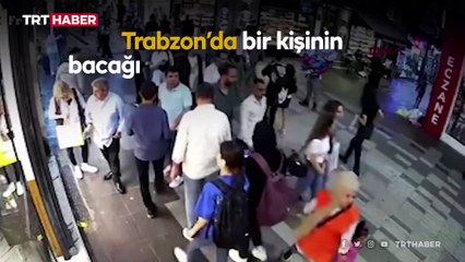 Yürürken yüzüne mermi isabet etti: O anlar kamerada