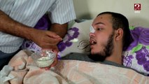 طه محمد.. معاناة شاب انتصر على السرطان وأصيب بالفطر الأسود وأسرته تطلب المساعدة في علاجه