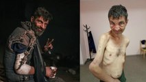 Released Ukrainian prisoner of war reveals torment at the hands of Russians