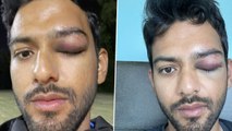 Unmukt Chand అథ్లెట్ అంటే అంత ఈజీ కాదు బ్రో *Cricket | Telugu OneIndia