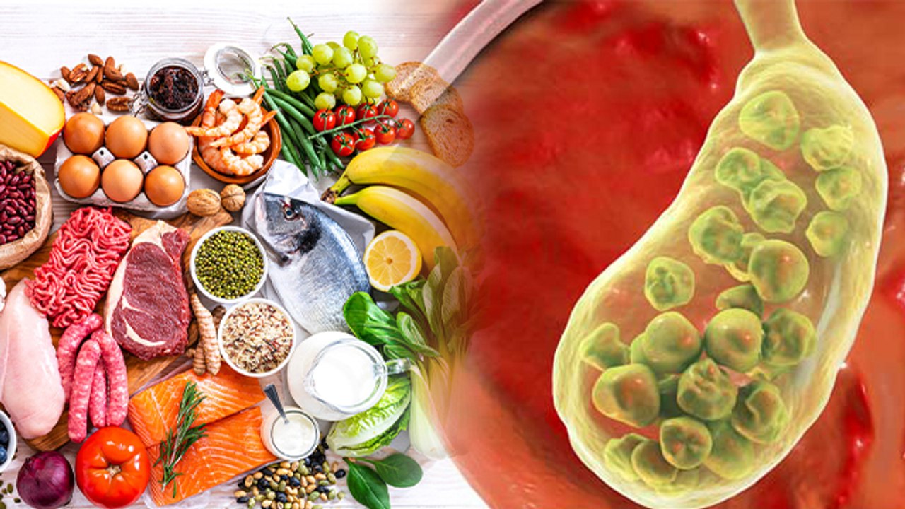 Gallbladder Stone में क्या खाएं क्या नहीं ? | Gallbladder Stone me kya khaye kya na khaye | *health