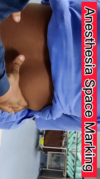 Spinal Anesthesia Space Marking by Anesthesia Technologist in Cardiology Hospital