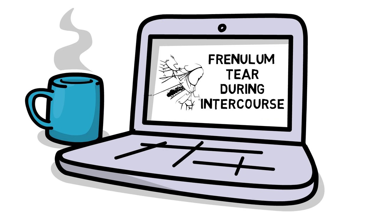 Frenulum Tear: What to Do & How to Speed Up Healing - video Dailymotion