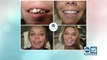 Smile big for the camera with Gasser Dental Implants