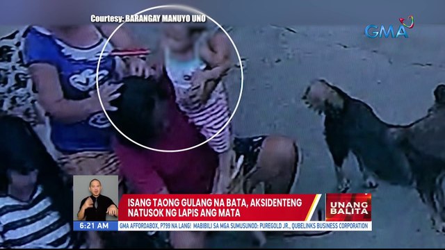 Isang taong gulang na bata, aksidenteng natusok ng lapis ang mata | UB