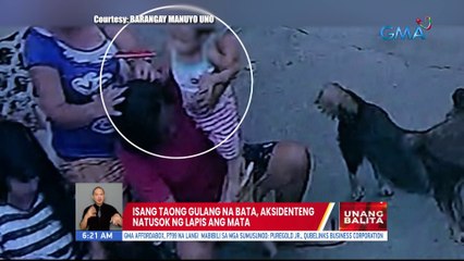 Isang taong gulang na bata, aksidenteng natusok ng lapis ang mata | UB
