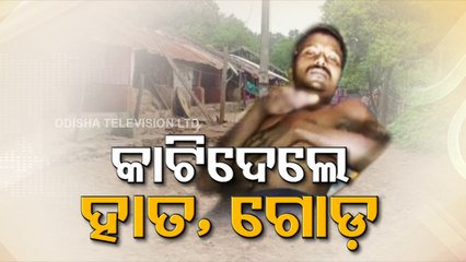 Odisha migrant labourer's leg, palm chopped off by middlemen for demanding wages