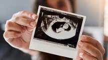 Bebek cinsiyeti ne zaman belli olur? Hamilelikte bebeğin cinsiyeti ne zaman kesinleşir?