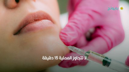 كل ما تريد معرفته عن فيلر الذقن - الأنواع والطريقة والتأثيرات والسعر