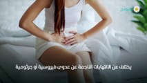 علاج التهابات المهبل للمتزوجات بمختلف الطرق