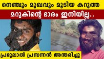 മുഖം മൂടിയ കറുത്ത രോ​ഗത്തോട് പോരാടി പ്രഭുലാൽ യാത്രയായി | *Kerala