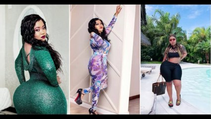 Vera Sidika Undergoes Booty Reduction Surgery Over Health Risk: "Love Yourselves"