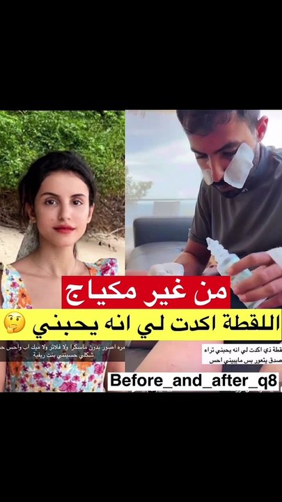 فوز العتيبي تظهر بدون فلتر او مكياج والجمهور مصدوم