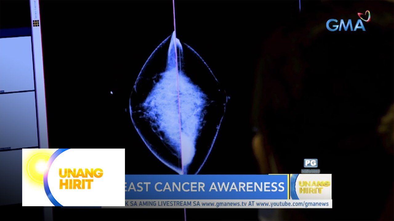 Facts and myths tungkol sa breast cancer, alamin!