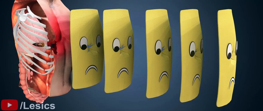 Chalecos antibalas | La Asombrosa Ingeniería detrás de la Tecnología Salvavidas