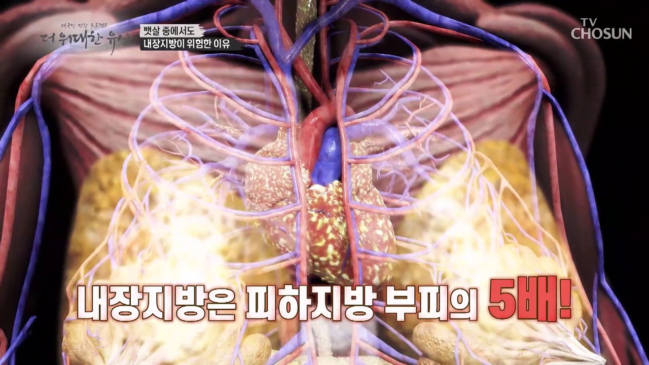 혈관을 타고 돌면서 생명을 위협하는 ‘내장지방’ TV CHOSUN 20221006 방송