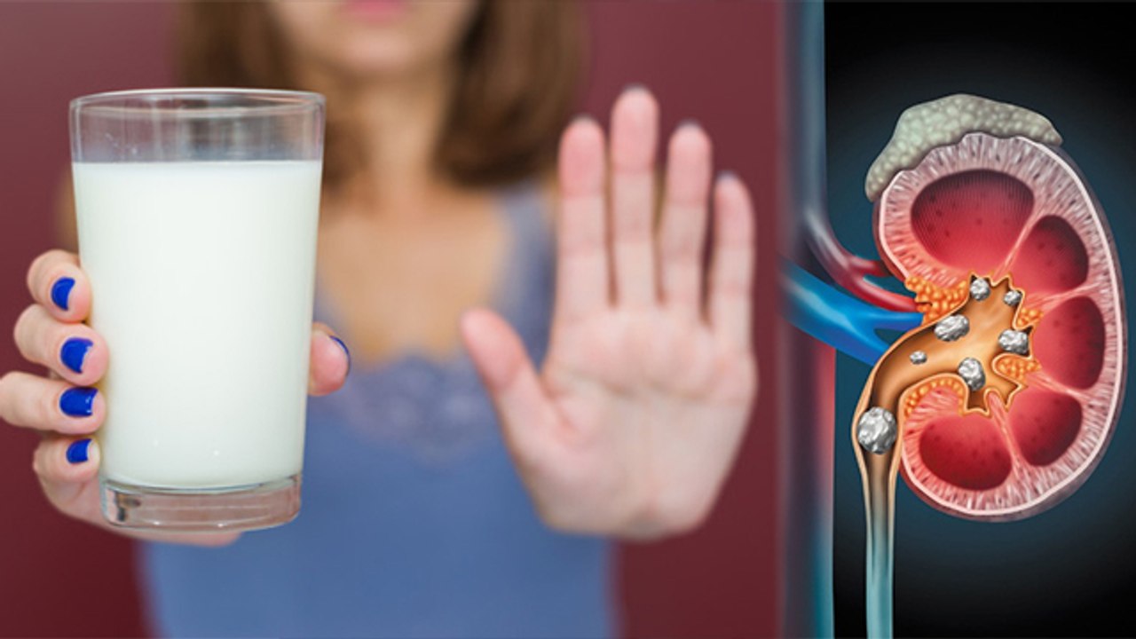 पथरी में दूध पीना चाहिए या नहीं Kidney Stone me Milk peene se kya